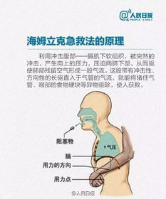 1岁女童喝酸奶窒息,护士抱起就是一个狂奔 最后孩子哭了,她也哭了 