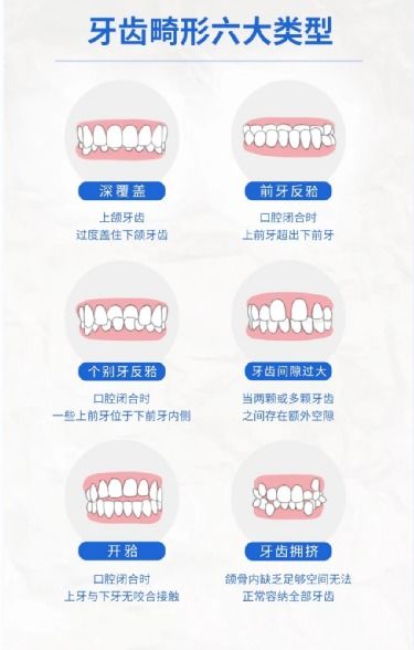 1万元牙套就能赚7000 到底什么样的牙才需要 整 教你不花冤枉钱