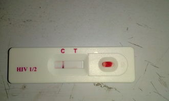 网上买的艾滋病检测快速自检试剂盒AIDS爱滋HIV病毒血检试纸 检测准吗