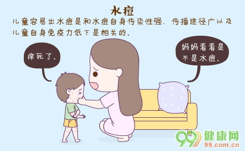 水痘