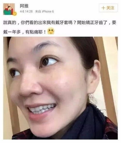 邓紫棋 徐娇 贾斯汀 比伯等明星都有做了什么变得如此帅美 