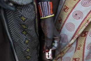 非洲女子割礼后的照片 揭非洲少女割礼全过程