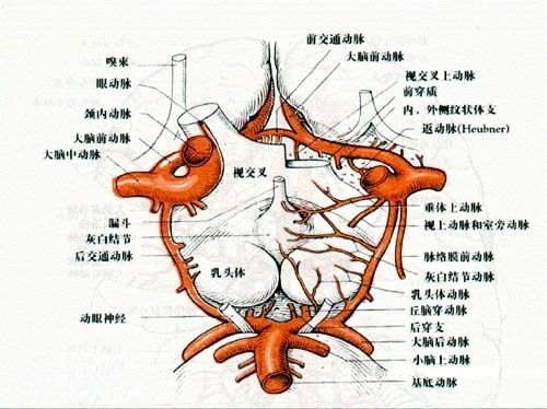 小中风和中风