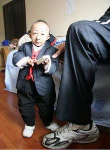 中国第一袖珍人,何平平身高74.61cm 出生时仅1斤重