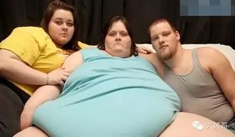 世界上最胖的人 苏珊娜·埃曼目前体重1450公斤