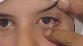 印尼女孩被称为钻石眼泪女