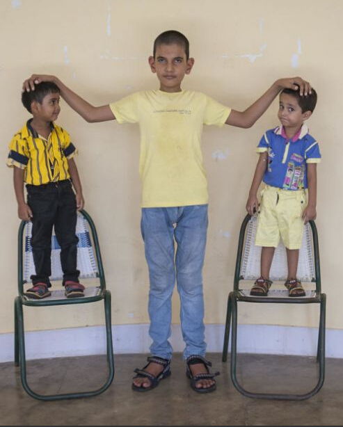 印度5岁男童身高1.75米 出生破世界纪录