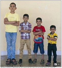 印度5岁男童身高1.75米 人类无法阻止他生长了 