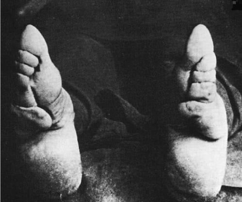 清朝真实老照片 古代缠足女子的脚,最后一张是 大猪蹄子