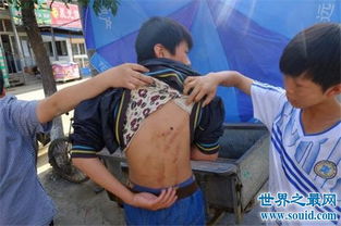 北京奶西村少年暴力事件,少年被打昏面部被尿 