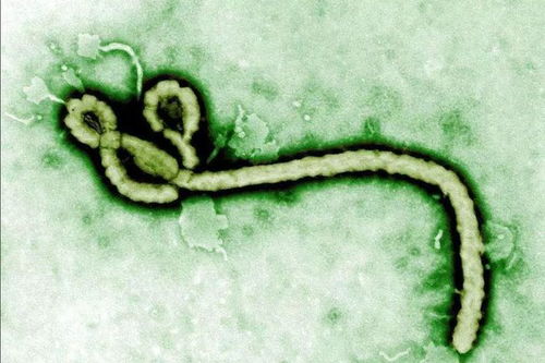 埃博拉病毒又诡异出现 1100万人爆发饥荒 非洲,比你想的更难
