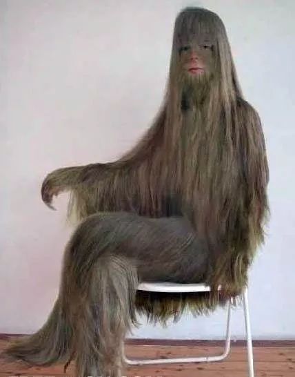 世界上毛发最多的人 艾米丽是目前吉尼斯世界纪录官方承认的世界 世界上谁的毛发最多