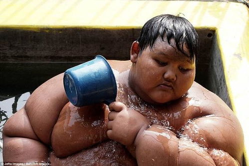 世界最胖的男孩 重达384斤,每天需要吃五顿饭
