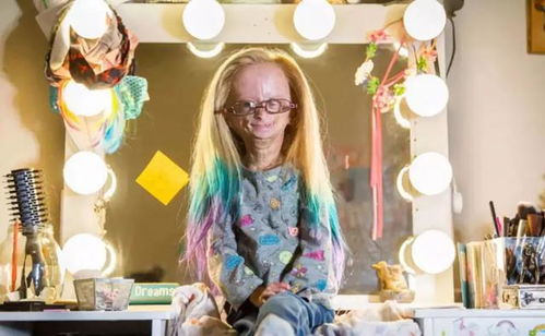 早衰症女孩（Adalia Rose）拍搞笑视频成网红(早衰症女孩小凤整容后)