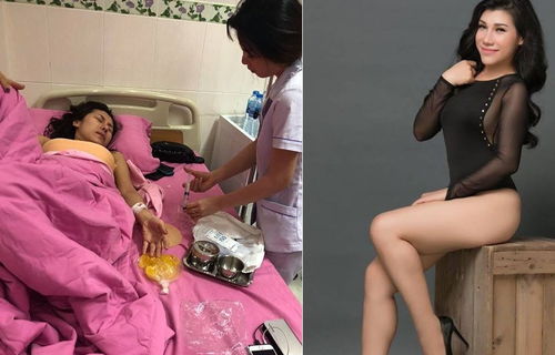 女星（Ivy Chen ）乘飞机胸爆了 胸部填充物爆炸