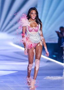 白癜风超模（Winnie Harlow）维密首秀 奶牛妹妹演绎红色诱惑