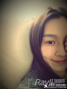 范玮琪:女演员摔伤缝15针 但被质疑卖惨