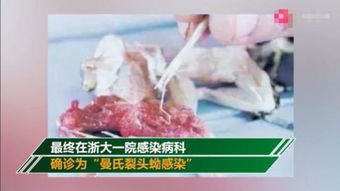 浙江衢州常山县28岁男孩16年前开始出现癫痫和头晕(浙江衢州常山县2022年4月16道路通行吗)