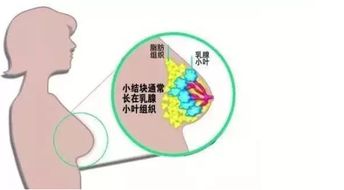 美国强生向男子支付80亿美元惩罚性赔偿