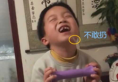 爸爸用最传统的方法帮儿子拔牙,震惊了