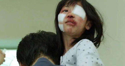 素媛原型娜英还活着吗?(素媛原型娜英伤口)