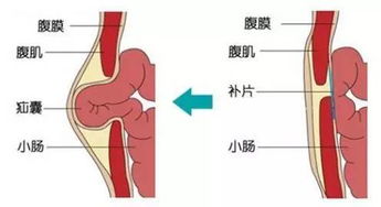 2008年韩国娜英事件:凶手为什么毁了素媛的肛门?(2008年韩国娜英案)