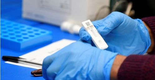 英国新冠死亡病例有多少：住院的新冠肺炎患者中有三分之一死亡(英国1月就出现新冠死亡病例)