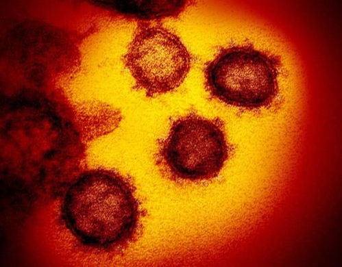 美国最新研究：新冠病毒不仅影响肺部 也会导致大脑发炎(美国强迫症最新研究)