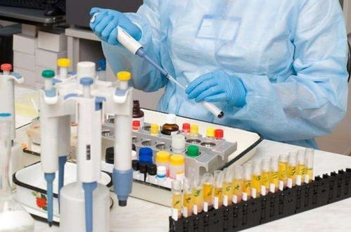 研究称英国人口中高达25%的人可能已经感染过新冠病毒