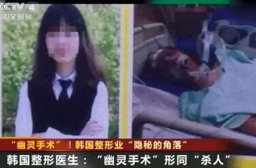 韩国整形业幽灵手术遭曝光:术前承诺由专业医生主刀,实际做手术(韩国整形业幽灵手术遭曝光 小说)