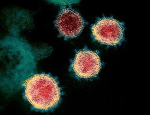 南非新冠肺炎样本被抢劫,人们担心生物危害(南非新冠肺炎最新消息)