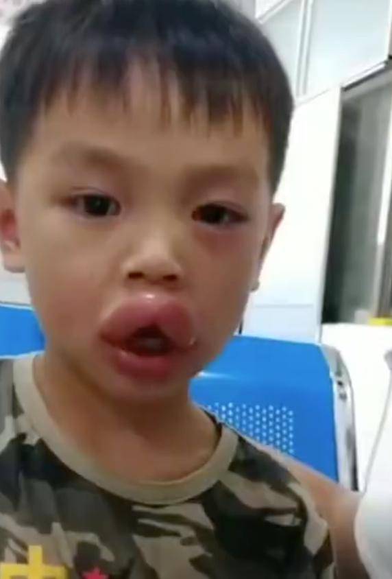 父亲表示:虽然很心疼孩子,但是看到嘟嘟嘴还是忍不住笑了(表示对父亲的爱)