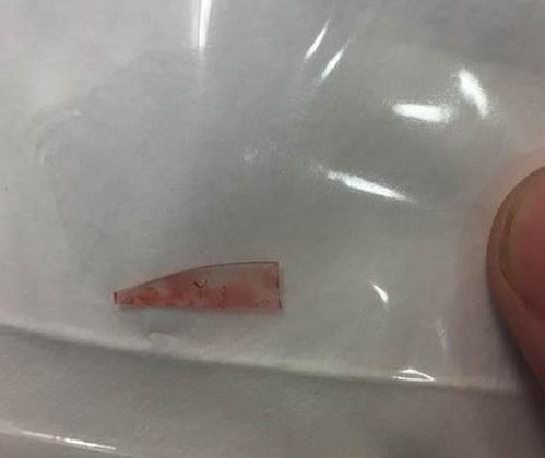 女子发现浴室天花板鼓起了一个巨大袋子