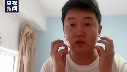 大连男孩再次进入隔离区,热出花癣斑