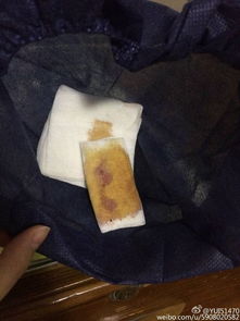 海南医学院第一附属医院针灸科拔火罐 颈部皮肤受伤(海南医学院第一附属医院)