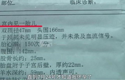 女性花10万做全麻整形手术 术后检查发现自己怀孕4个月(女性什么手术要花10万以上)