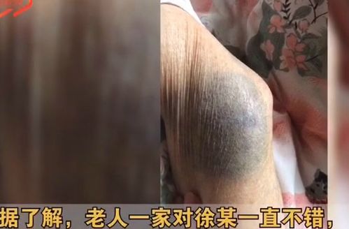 保姆虐待85岁老人 59岁徐在朝阳法院受审