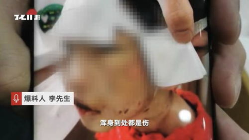 内蒙古8岁女孩被父母虐待,网友:我想领养,一直喜欢孩子要不上(内蒙古名字大全女孩)
