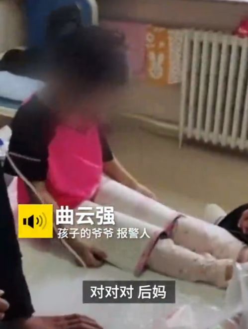 被虐待的女孩需要整形手术
