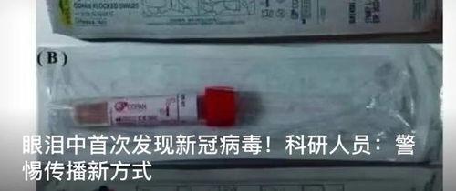 马内新冠肺炎检测中呈阳性将开始自我隔离