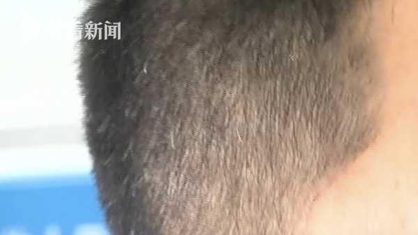 90后小伙为治白发疯狂吃何首乌,没想到20天后身体发生了惊人
