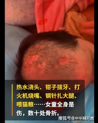 辽宁抚顺6岁女孩被母亲和男友虐待 引发关注(辽宁抚顺6岁女孩童童开庭现场)