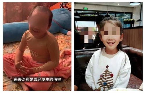 心理专家解读6岁被虐女孩案:孩子的母亲和男朋友是反社会人格的(名侦探柯南之心理专家)