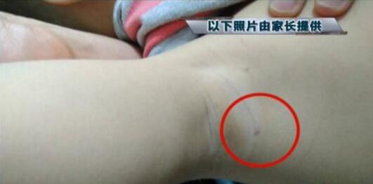 鼎奇昭君幼儿园教师虐待被护理人(鼎奇幼儿园昭君园)