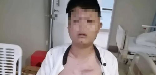 退货时骨头被打断 老板突然生气说凌买不起就别吃了