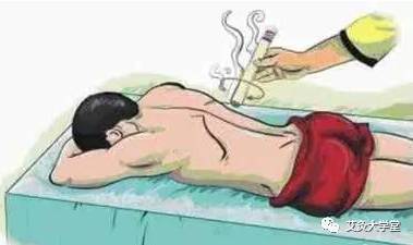 特别是这八种人不能艾灸