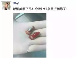 戴戒指不打保龄球真相图片 戴戒指打保龄球原图吓人