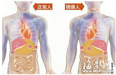 镜像人确实存在,但概率只有数百万分之一 镜像伦敦真的存在吗