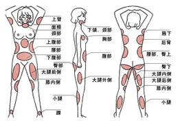 吸脂真的可靠吗?(免费吸脂可靠吗)