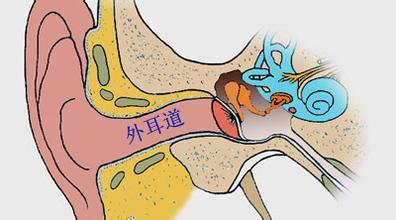治疗外耳炎需要多少钱?(孩子外耳炎怎么治疗)